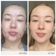 Advanced Nutrition Programme Skin Accumax Supplement distributed by jane iredale, 30-day supply