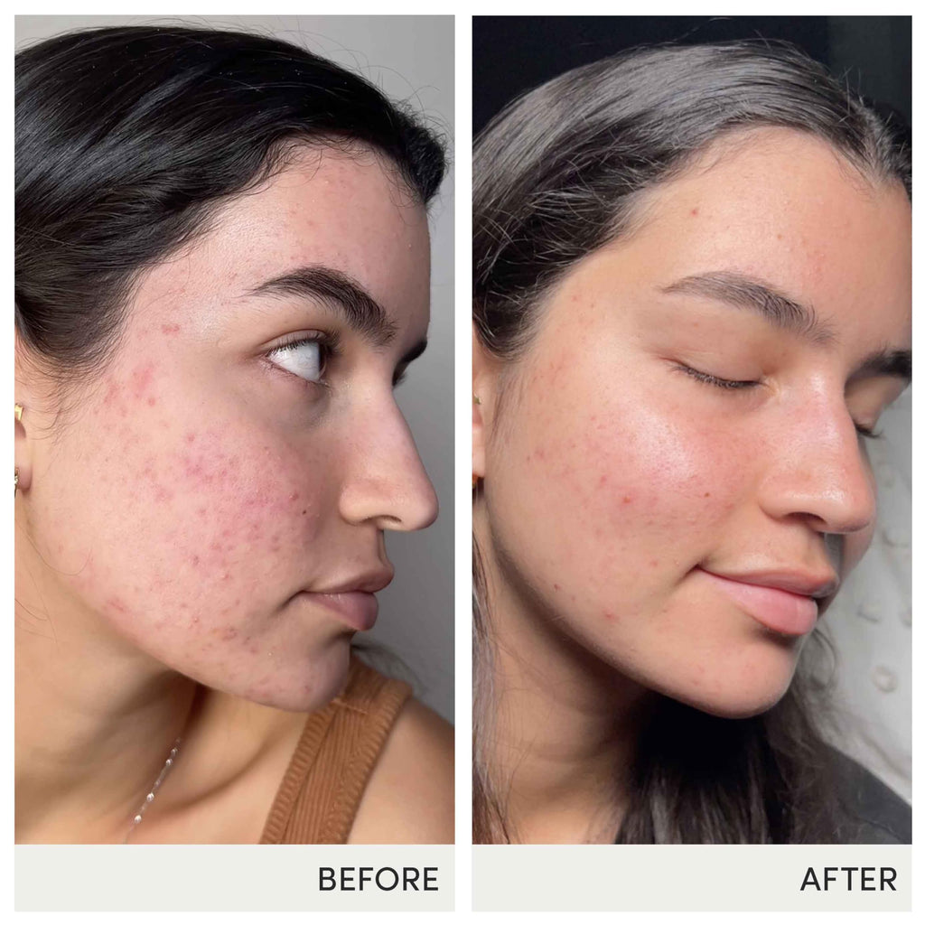 Advanced Nutrition Programme Skin Accumax Supplement distributed by jane iredale, 30-day supply