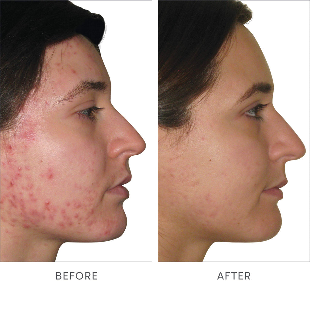 Advanced Nutrition Programme Skin Accumax Supplement distributed by jane iredale, 30-day supply